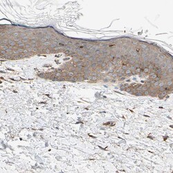 Invitrogen P4HA1 Polyclonal Antibody 100 &mu;L; Unconjugated:Antibodies,