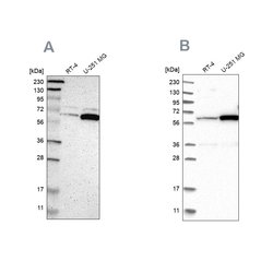 Invitrogen P4HA1 Polyclonal Antibody 100 &mu;L; Unconjugated:Antibodies,