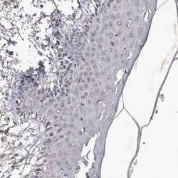 Invitrogen MGAT4A Polyclonal Antibody 100 &mu;L; Unconjugated:Antibodies,