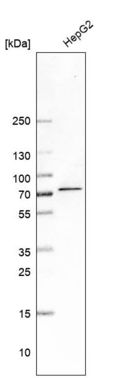 Invitrogen MGAT4A Polyclonal Antibody 100 &mu;L; Unconjugated:Antibodies,