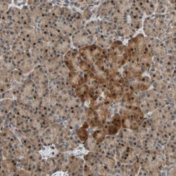Invitrogen HECW1 Polyclonal Antibody 100 &mu;L; Unconjugated:Antibodies,