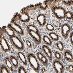 Invitrogen GALNT3 Polyclonal Antibody 100 &mu;L | Buy Online | Invitrogen&trade; | Fisher Scientific