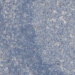 Invitrogen GALNT3 Polyclonal Antibody 100 &mu;L | Buy Online | Invitrogen&trade; | Fisher Scientific