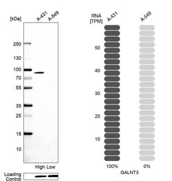 Invitrogen GALNT3 Polyclonal Antibody 100 &mu;L | Buy Online | Invitrogen&trade; | Fisher Scientific