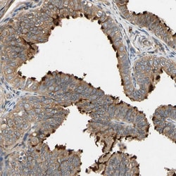 Invitrogen MGRN1 Polyclonal Antibody 100 &mu;L; Unconjugated:Antibodies,
