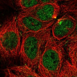 Invitrogen CaMKV Polyclonal Antibody 100 &mu;L | Buy Online | Invitrogen&trade; | Fisher Scientific