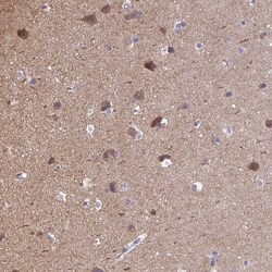 Invitrogen CaMKV Polyclonal Antibody 100 &mu;L | Buy Online | Invitrogen&trade; | Fisher Scientific