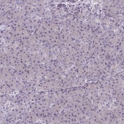 Invitrogen CaMKV Polyclonal Antibody 100 &mu;L | Buy Online | Invitrogen&trade; | Fisher Scientific
