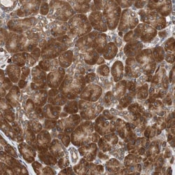 Invitrogen AUP1 Polyclonal Antibody 100 &mu;L; Unconjugated:Antibodies,