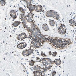 NIM1 Polyclonal Antibody:Antibodies, Polyclonal