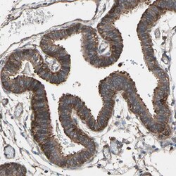 Invitrogen CCP2 Polyclonal Antibody 100 &mu;L; Unconjugated:Antibodies,