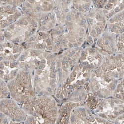 Invitrogen CCP2 Polyclonal Antibody 100 &mu;L; Unconjugated:Antibodies,