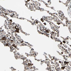 Invitrogen CCP2 Polyclonal Antibody 100 &mu;L; Unconjugated:Antibodies,