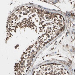 Invitrogen CCP2 Polyclonal Antibody 100 &mu;L; Unconjugated:Antibodies,