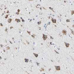 Invitrogen PLCXD1 Polyclonal Antibody 100 &mu;L; Unconjugated:Antibodies,