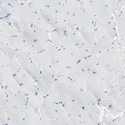 Invitrogen PLCXD1 Polyclonal Antibody 100 &mu;L; Unconjugated:Antibodies,