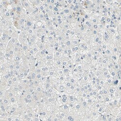 Invitrogen Brevican Polyclonal Antibody 100 &mu;L; Unconjugated:Antibodies,