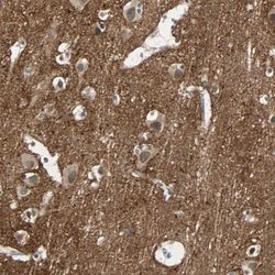 Invitrogen Brevican Polyclonal Antibody 100 &mu;L; Unconjugated:Antibodies,