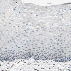 Invitrogen ABCA3 Polyclonal Antibody 100 &mu;L | Buy Online | Invitrogen&trade; | Fisher Scientific