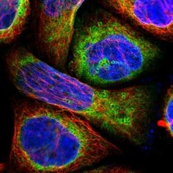 Invitrogen LPCAT2 Polyclonal Antibody 100 &mu;L; Unconjugated:Antibodies,