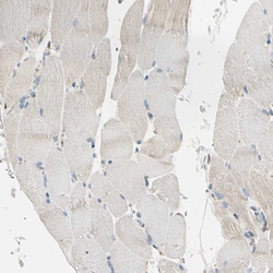 Invitrogen LPCAT2 Polyclonal Antibody 100 &mu;L; Unconjugated:Antibodies,