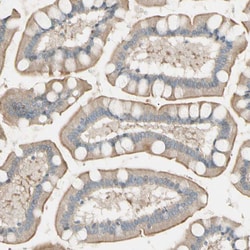 Invitrogen LPCAT2 Polyclonal Antibody 100 &mu;L; Unconjugated:Antibodies,
