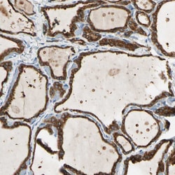 Invitrogen LPCAT2 Polyclonal Antibody 100 &mu;L; Unconjugated:Antibodies,