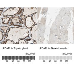 Invitrogen LPCAT2 Polyclonal Antibody 100 &mu;L; Unconjugated:Antibodies,
