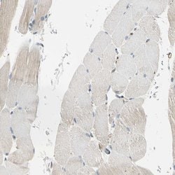 Invitrogen LPCAT2 Polyclonal Antibody 100 &mu;L; Unconjugated:Antibodies,