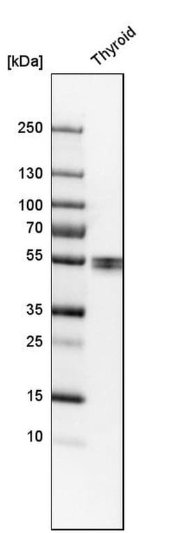 Invitrogen LPCAT2 Polyclonal Antibody 100 &mu;L; Unconjugated:Antibodies,