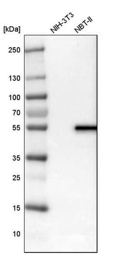 Invitrogen LPCAT2 Polyclonal Antibody 100 &mu;L; Unconjugated:Antibodies,