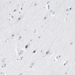 Invitrogen ZSCAN1 Polyclonal Antibody 100 &mu;L; Unconjugated:Antibodies,