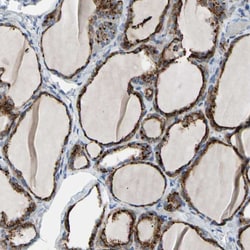 Invitrogen RETSAT Polyclonal Antibody 100 &mu;L; Unconjugated:Antibodies,
