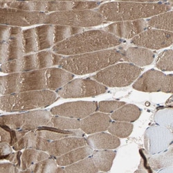 Invitrogen XYLT1 Polyclonal Antibody 100 &mu;L; Unconjugated:Antibodies,