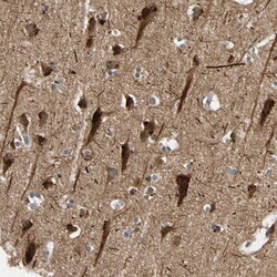 Invitrogen FGD6 Polyclonal Antibody 100 &mu;L; Unconjugated:Antibodies,