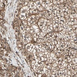 Invitrogen FKBP15 Polyclonal Antibody 100 &mu;L; Unconjugated:Antibodies,