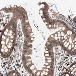 Invitrogen ALG5 Polyclonal Antibody 100 &mu;L; Unconjugated:Antibodies,