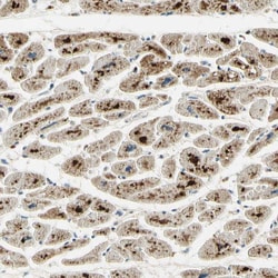 Invitrogen ARHGEF17 Polyclonal Antibody 100 &mu;L; Unconjugated:Antibodies,
