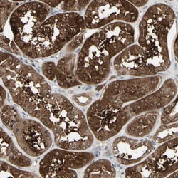 Invitrogen IGFBP6 Polyclonal Antibody 100 &mu;L; Unconjugated:Antibodies,