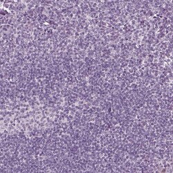 Invitrogen SLC6A17 Polyclonal Antibody 100 &mu;L; Unconjugated:Antibodies,