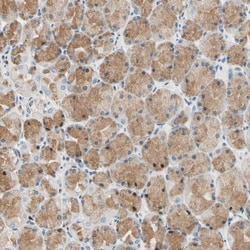Invitrogen Laminin beta-3 Polyclonal Antibody 100 &mu;L; Unconjugated:Antibodies,