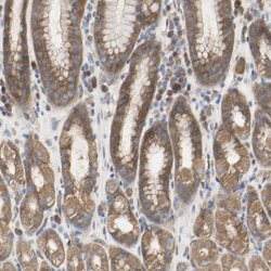 Invitrogen TTMP Polyclonal Antibody 100 &mu;L; Unconjugated:Antibodies,