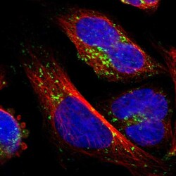 Invitrogen ATP6V1B2 Polyclonal Antibody 100 &mu;L; Unconjugated:Antibodies,