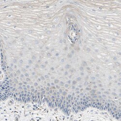 Invitrogen ATP6V1B2 Polyclonal Antibody 100 &mu;L; Unconjugated:Antibodies,