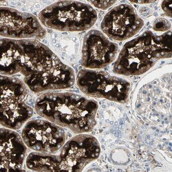 Invitrogen ATP6V1B2 Polyclonal Antibody 100 &mu;L; Unconjugated:Antibodies,