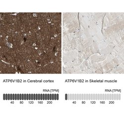 Invitrogen ATP6V1B2 Polyclonal Antibody 100 &mu;L; Unconjugated:Antibodies,