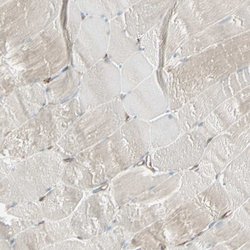 Invitrogen ATP6V1B2 Polyclonal Antibody 100 &mu;L; Unconjugated:Antibodies,