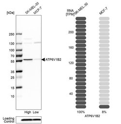 Invitrogen ATP6V1B2 Polyclonal Antibody 100 &mu;L; Unconjugated:Antibodies,