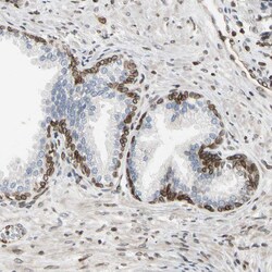 Invitrogen LAP2 Polyclonal Antibody 100 &mu;L; Unconjugated:Antibodies,