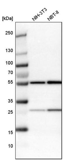 Invitrogen LAP2 Polyclonal Antibody 100 &mu;L; Unconjugated:Antibodies,